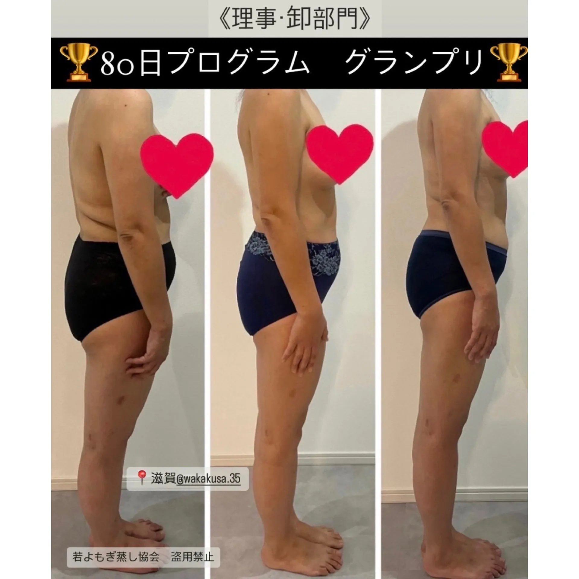 施術事例